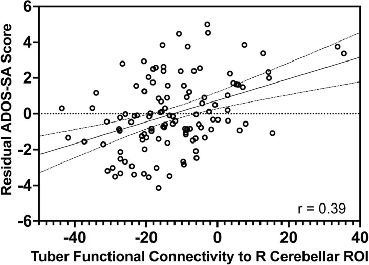 FIGURE 5 | Correlation between ADOS‐SA and connectivity. Graph shows correlation between ADOS‐SA residuals after subtracting the effect of covariates against each patient's tuber connectivity to the R cerebellar ROI. Spearman correlation yielded r = 0.39. Solid line indicates the linear regression with dashed lines indicating the 95% confidence interval. Alt text: Graphical representation of the residual ADOS‐SA score for each patient on the y axis and tuber functional connectivity to the cerebellar region of interest on the x axis. The line of best fit as well as 95% confidence is also plotted.