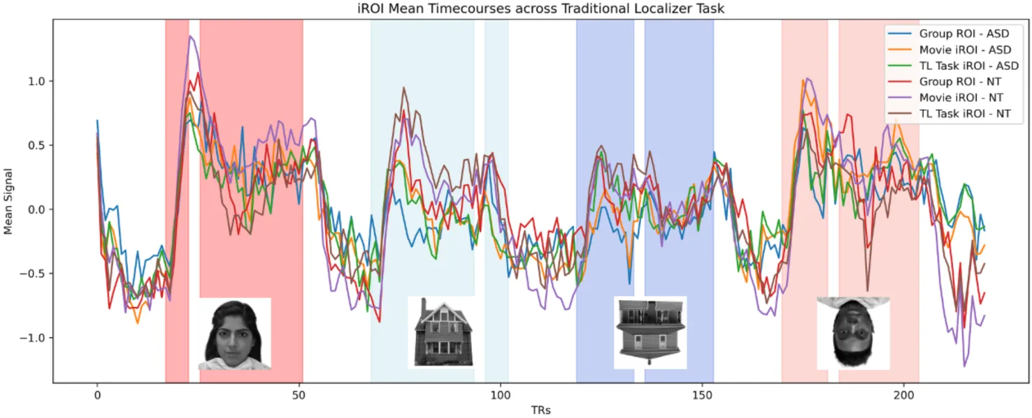 Fig. 5. Z-normalized mean timecourses from each ROI type applied to an independent run of the traditional localizer task in the left hemisphere, across ASD and NT groups. Right hemisphere time course looks very similar and so is not pictured here. White columns within blocks indicate presentation of flower stimulus.